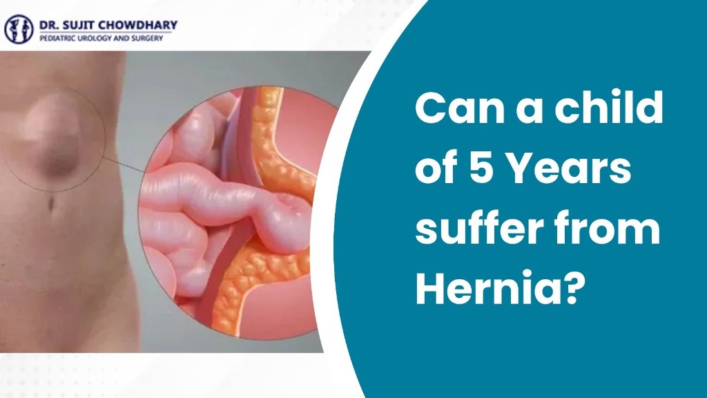 Can a child of 5 Years suffer from Hernia?