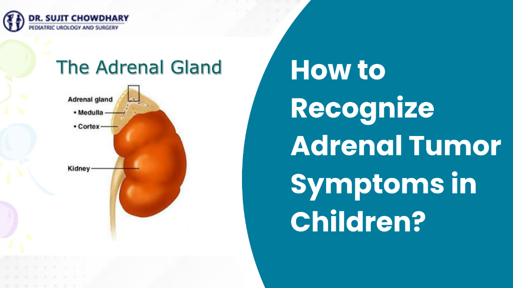How to Recognize Adrenal Tumor Symptoms in Children?
