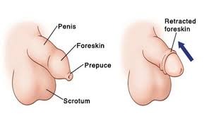 Normal Foreskin vs Retracted Foreskin Diagram